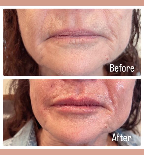 A before and after photo of a woman 's face