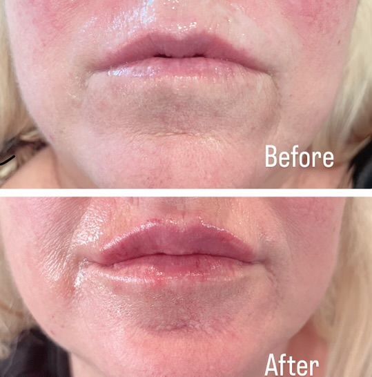 A before and after photo of a woman 's face