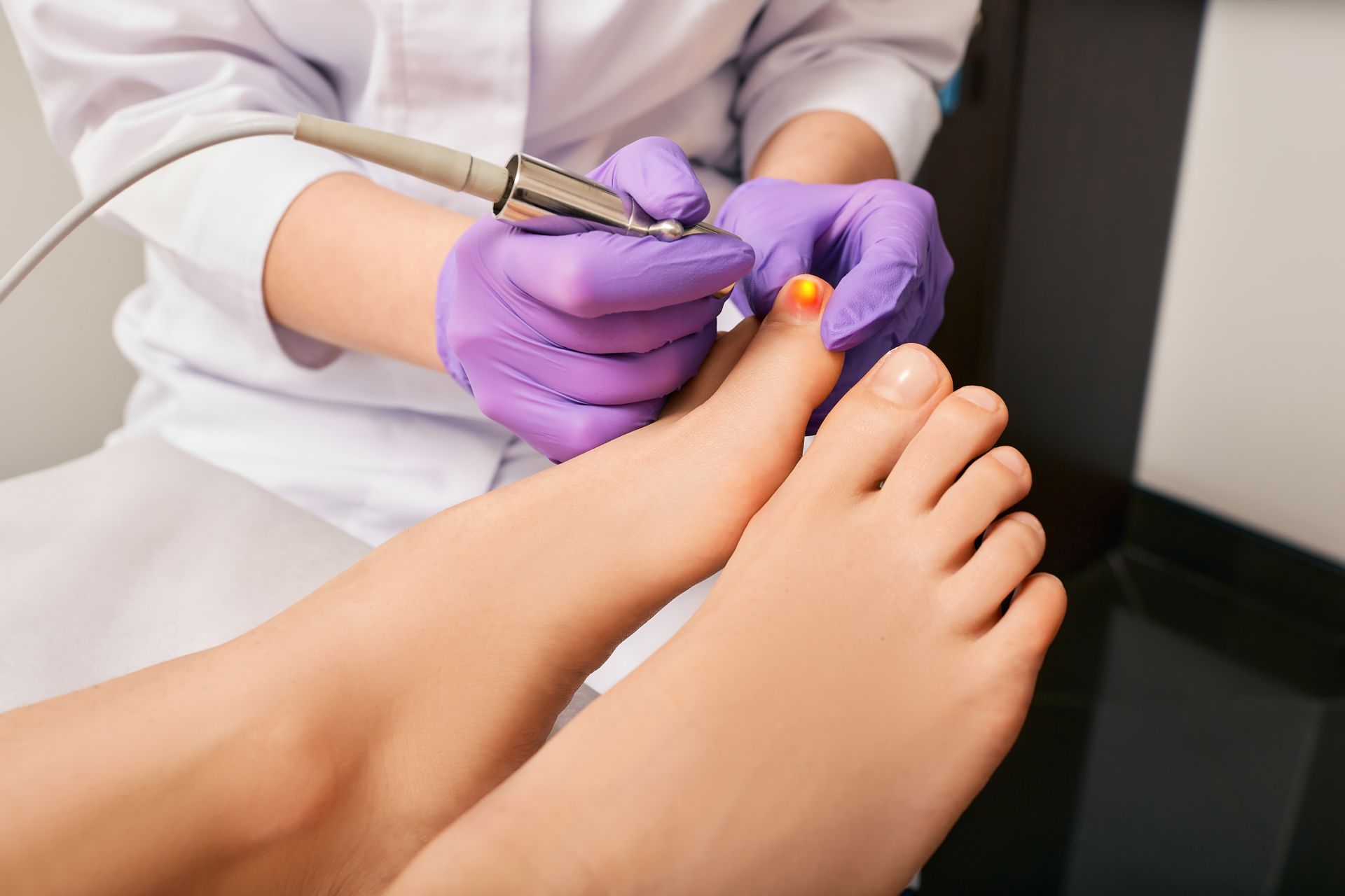 Podiatrist using a laser tool on a foot.
