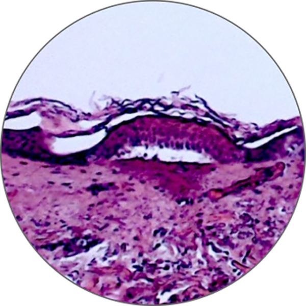 A Purple Type Tissue Under A Microscope — Sciton BBL Hero, Aura Mediclinic On The Gold Coast