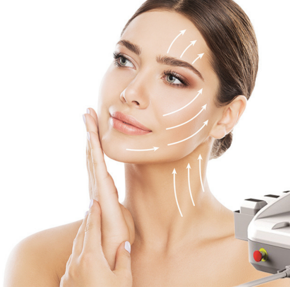 A Woman With Directions On Her Face For Where HIFU Is Done — Aura Mediclinic in Ashmore, QLD