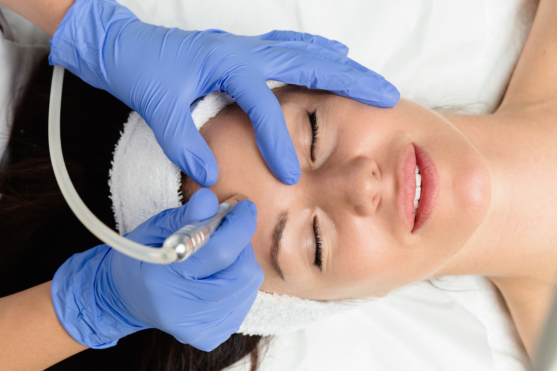 A Person in Blue Medical Gloves Uses a Microdermabrasion Device — Aura Mediclinic in Ashmore, QLD