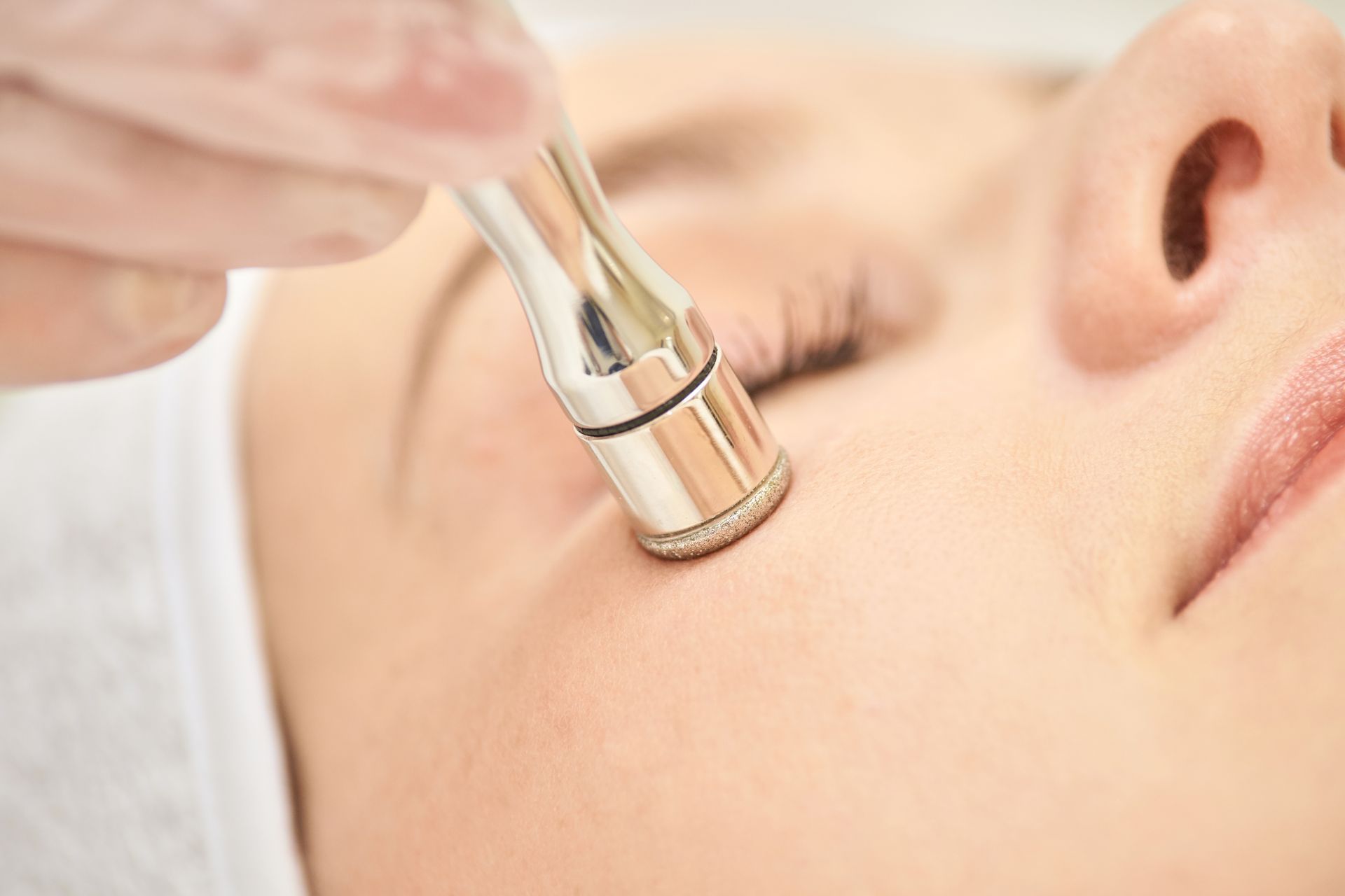 A Person Receiving a Diamond-tip Microdermabrasion Facial Treatment — Aura Mediclinic in Ashmore, QLD