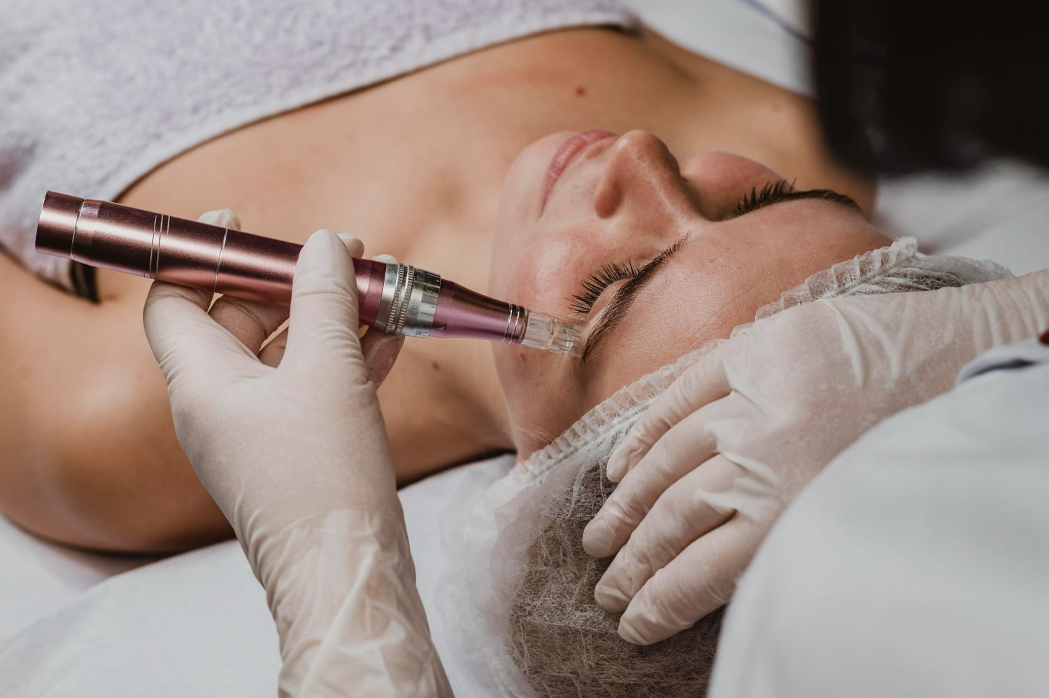 A woman is getting a microdermabrasion treatment on her face.