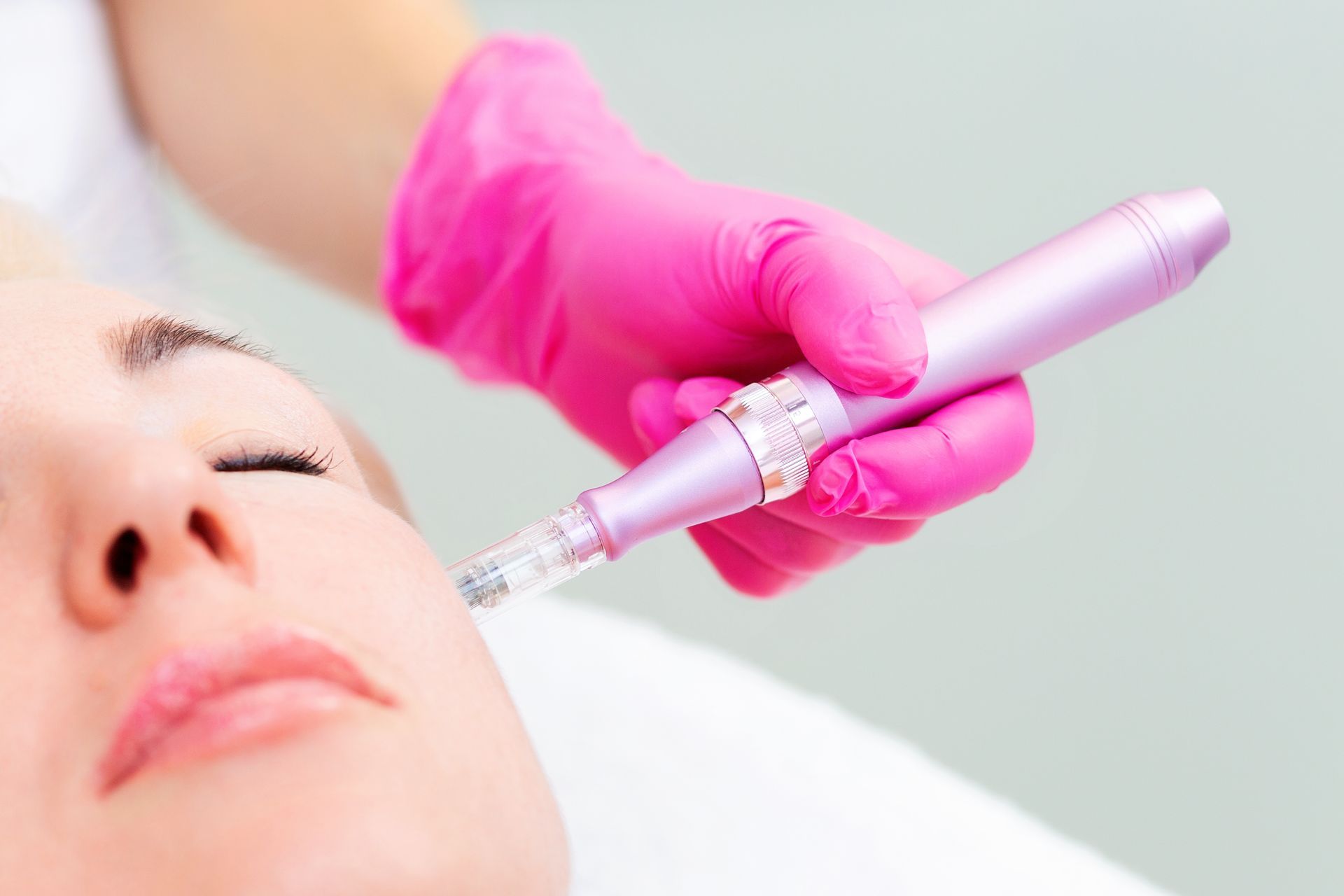 A woman is getting a microneedle treatment on her face.