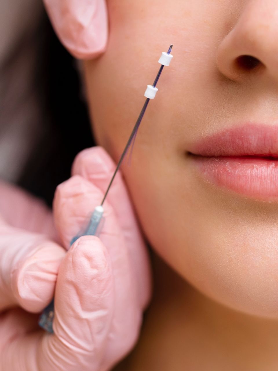 A woman is getting a botox injection in her face.