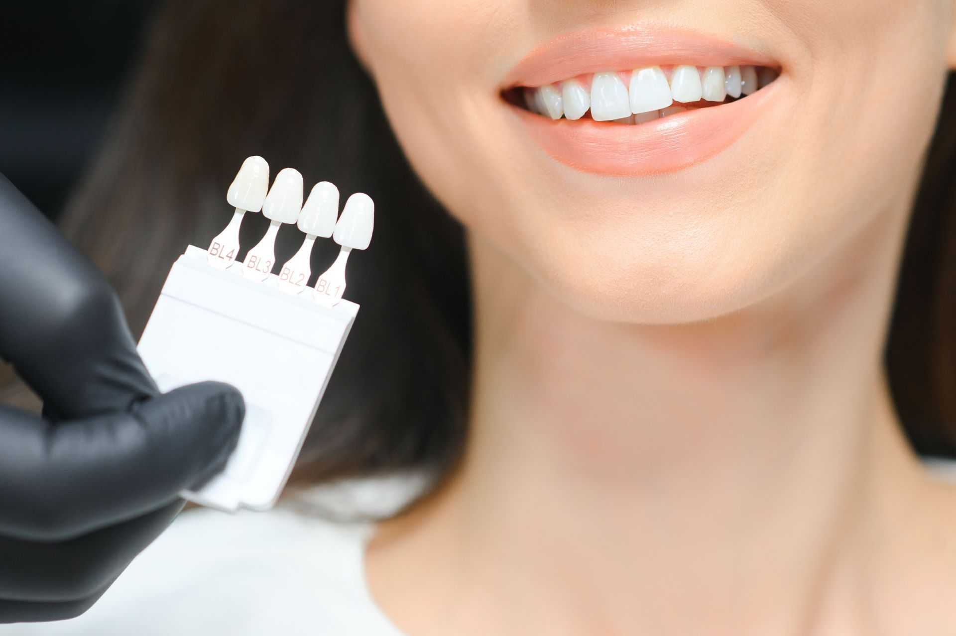 Woman's smile next to dental shade guide held by gloved hand, choosing tooth color.