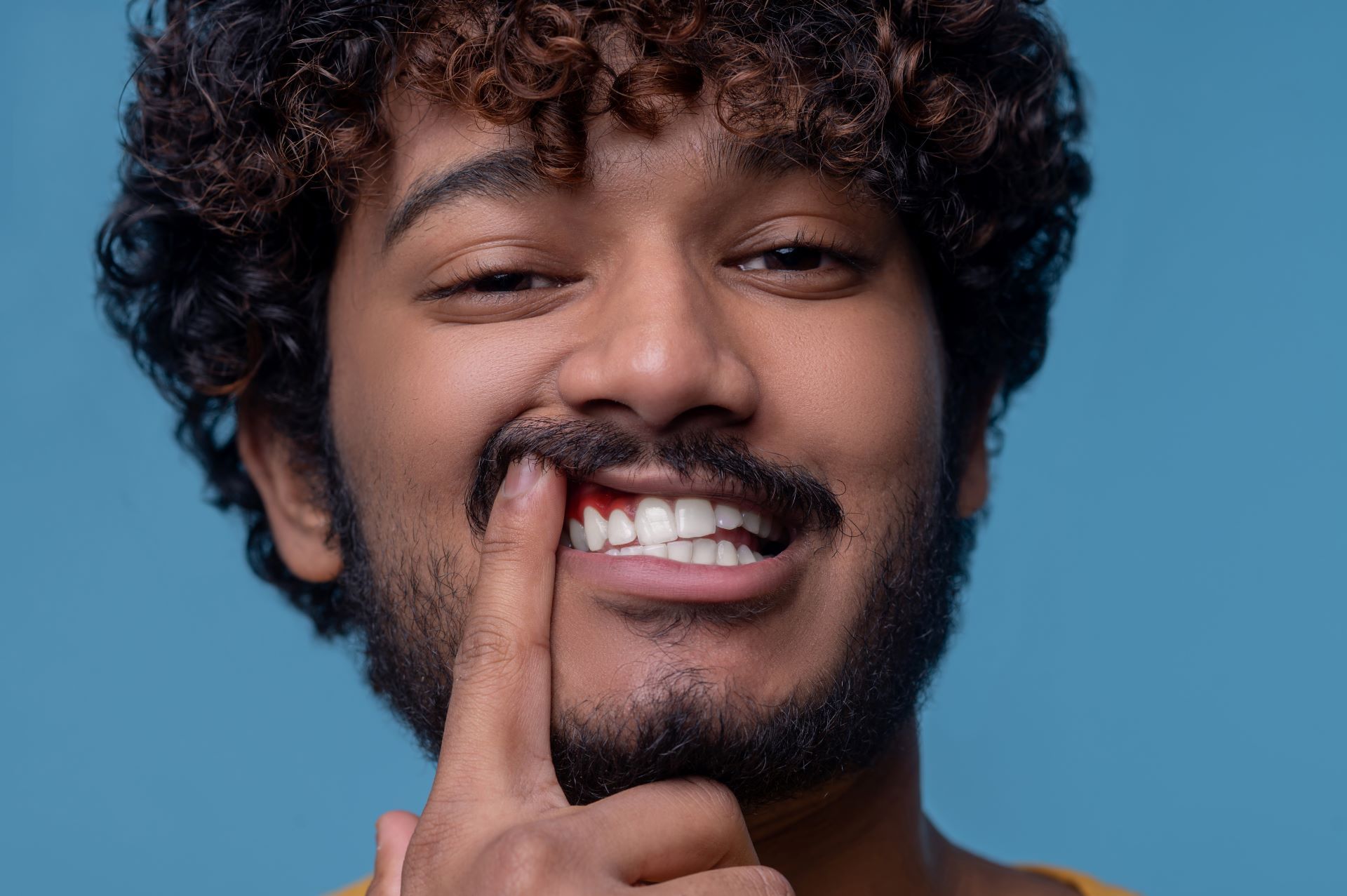 Closeup portrait of a male demonstrating his white teeth and periodontal disease before the camera