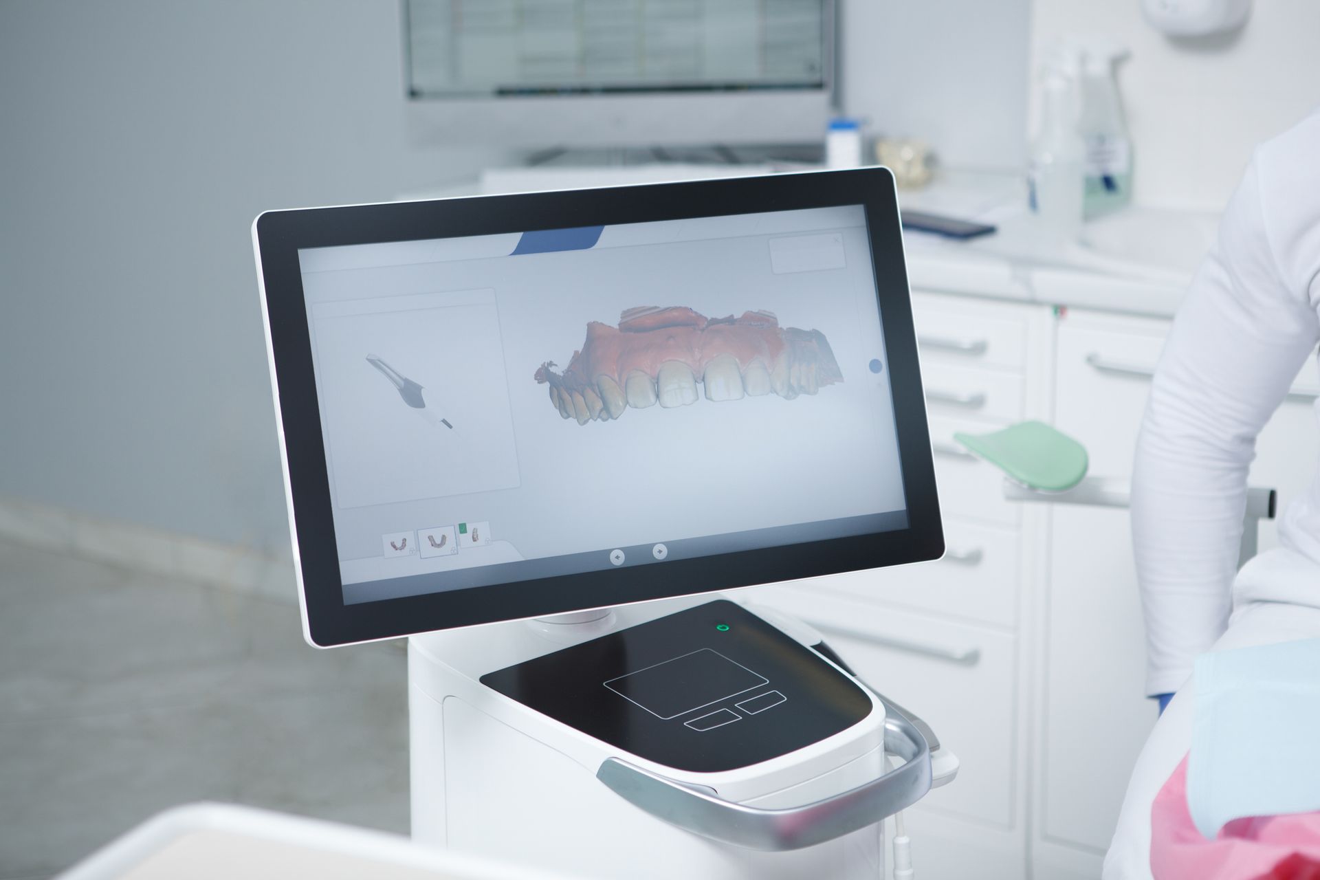 IMPRONTA DENTALE DIGITALE