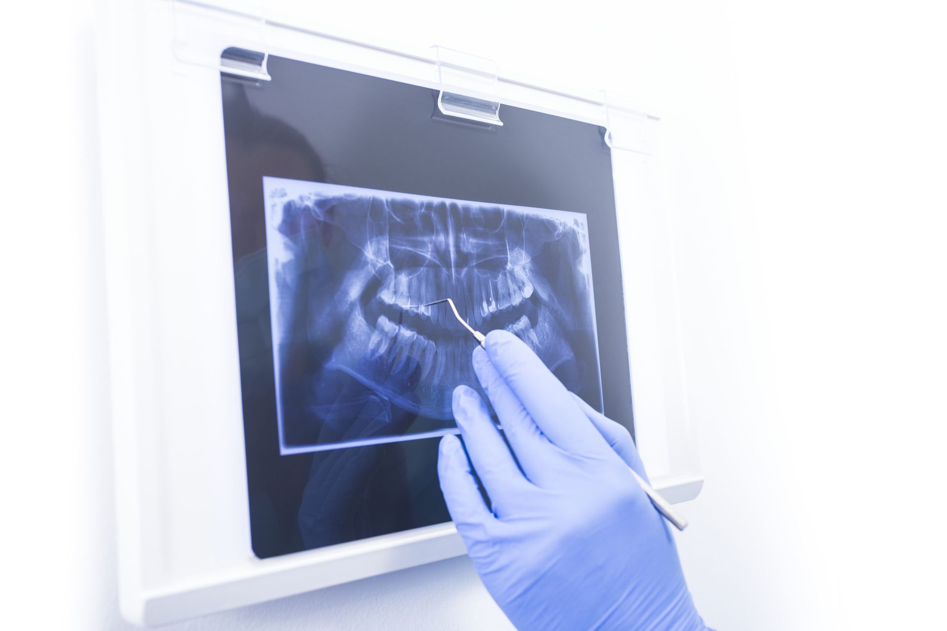RADIOLOGIA DIAGNOSTICA