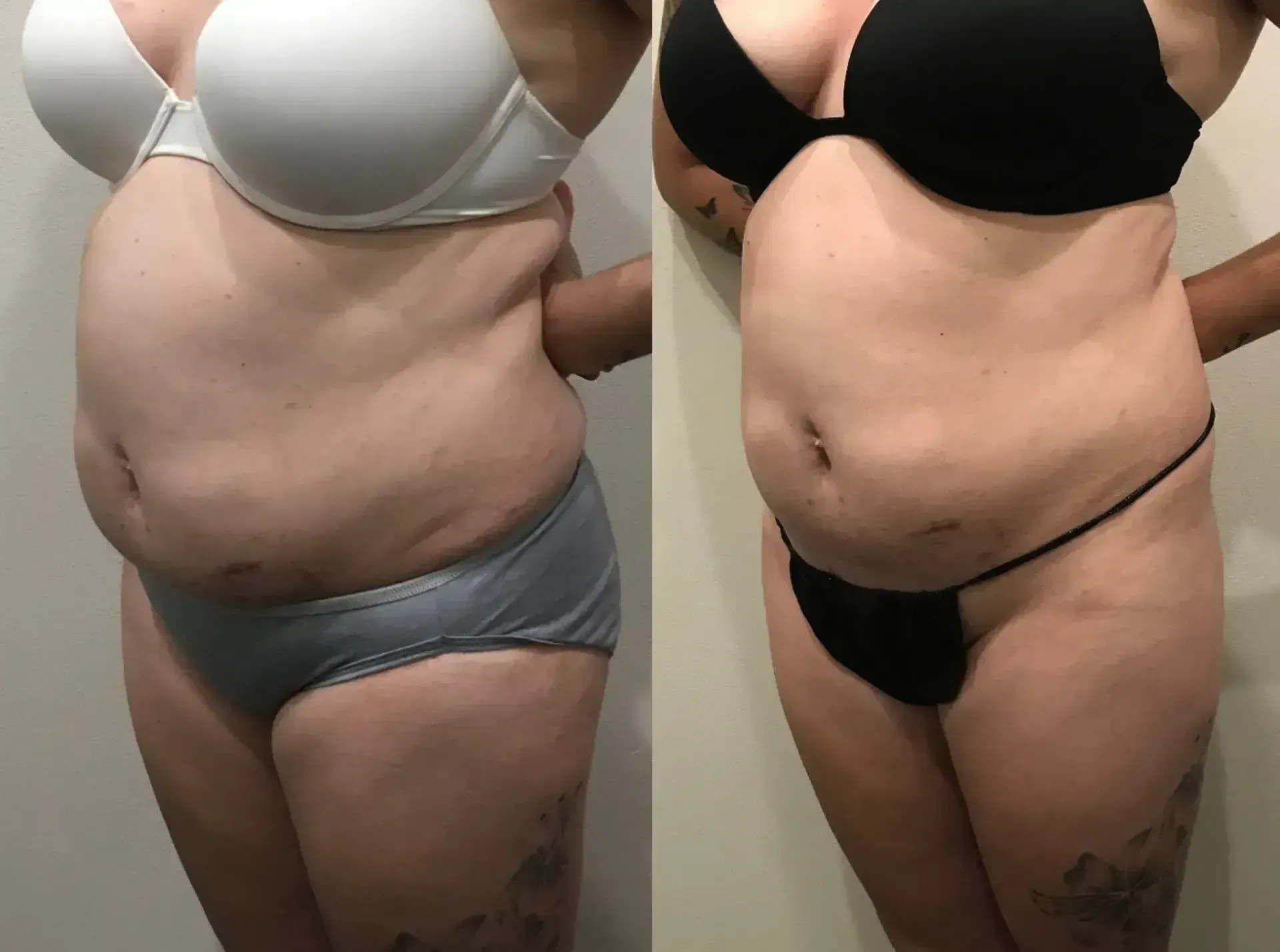 Two side-by-side photos of a person's torso. Shows a before and after comparison, with some fat loss.