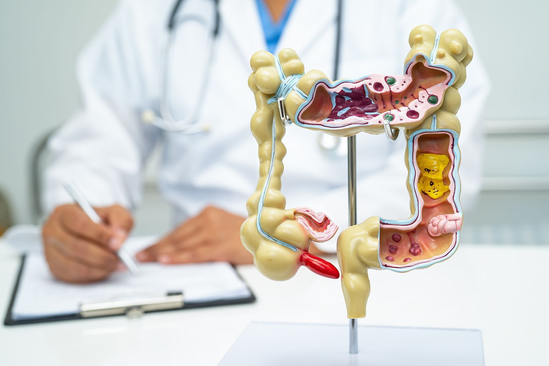 Doctor examining a model of a colon; a cross-section is visible.