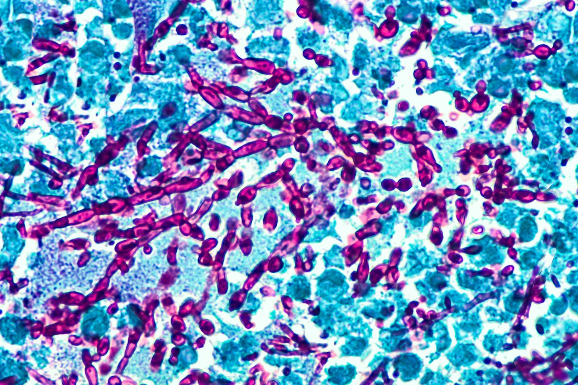 Microscopic view of stained fungal hyphae, appearing as branching, purplish filaments against a blue background.