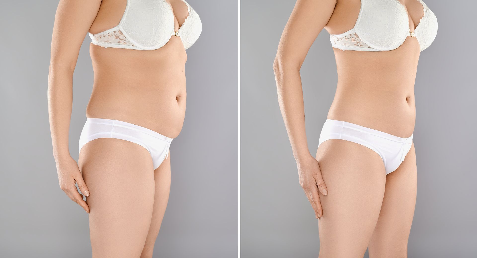 Side-by-side photos of a person in white underwear, showing a slimmer waist and hips on the right