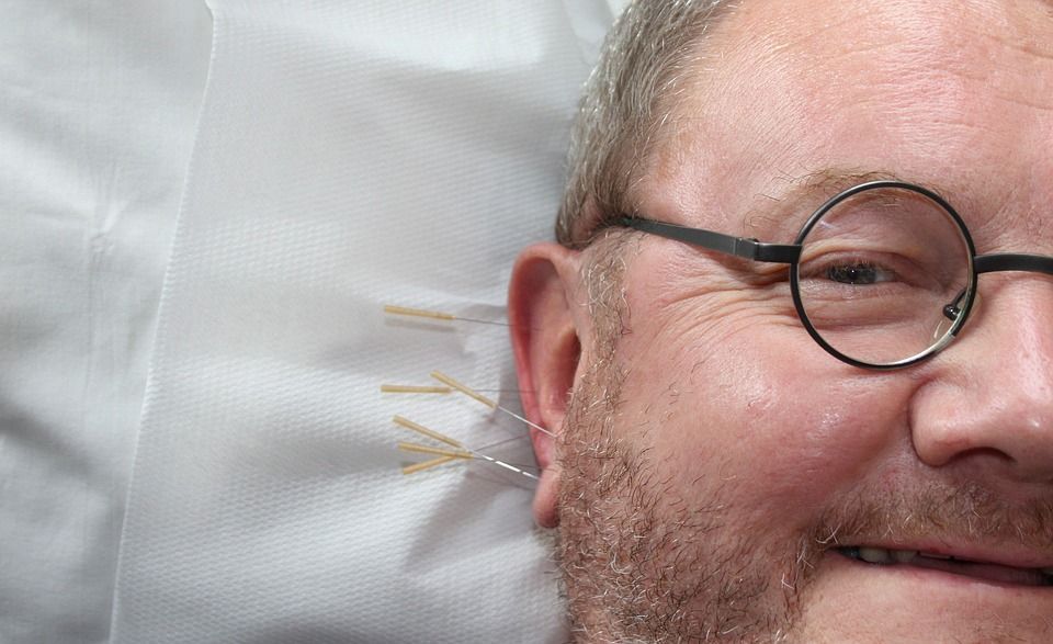 A man with glasses and a beard is laying on a bed with acupuncture needles in his ears.