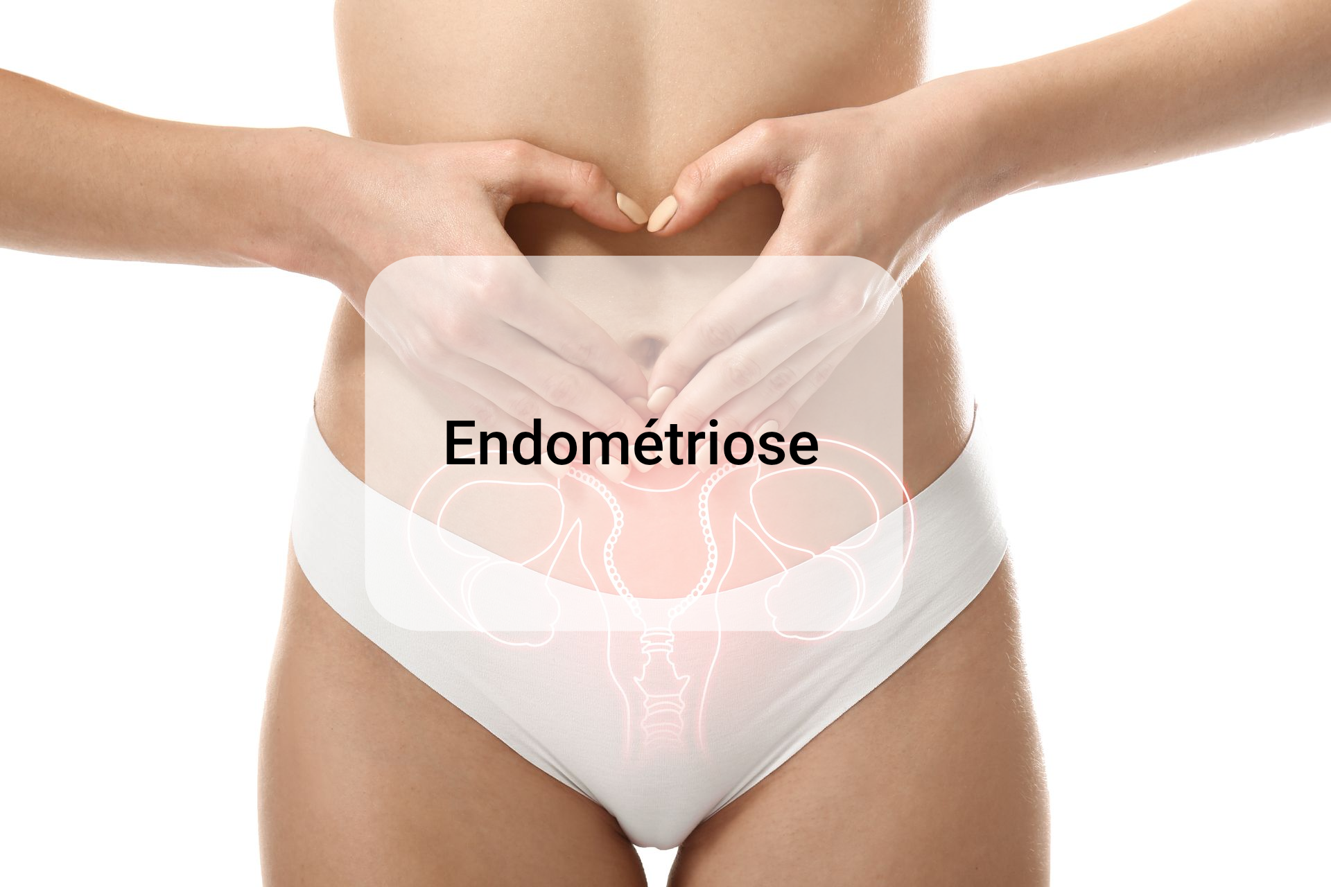endométriose femme 