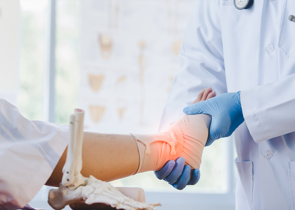 Ankle Fractures
