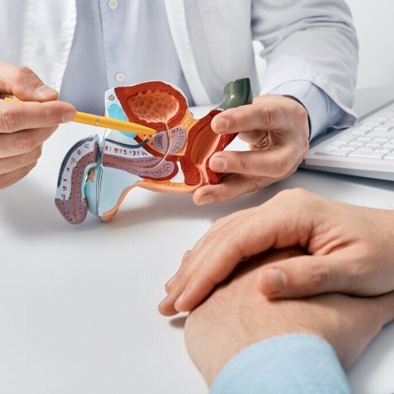 Il medico indica un modello anatomico dell'apparato urogenitale maschile e spiega come funziona a un paziente.