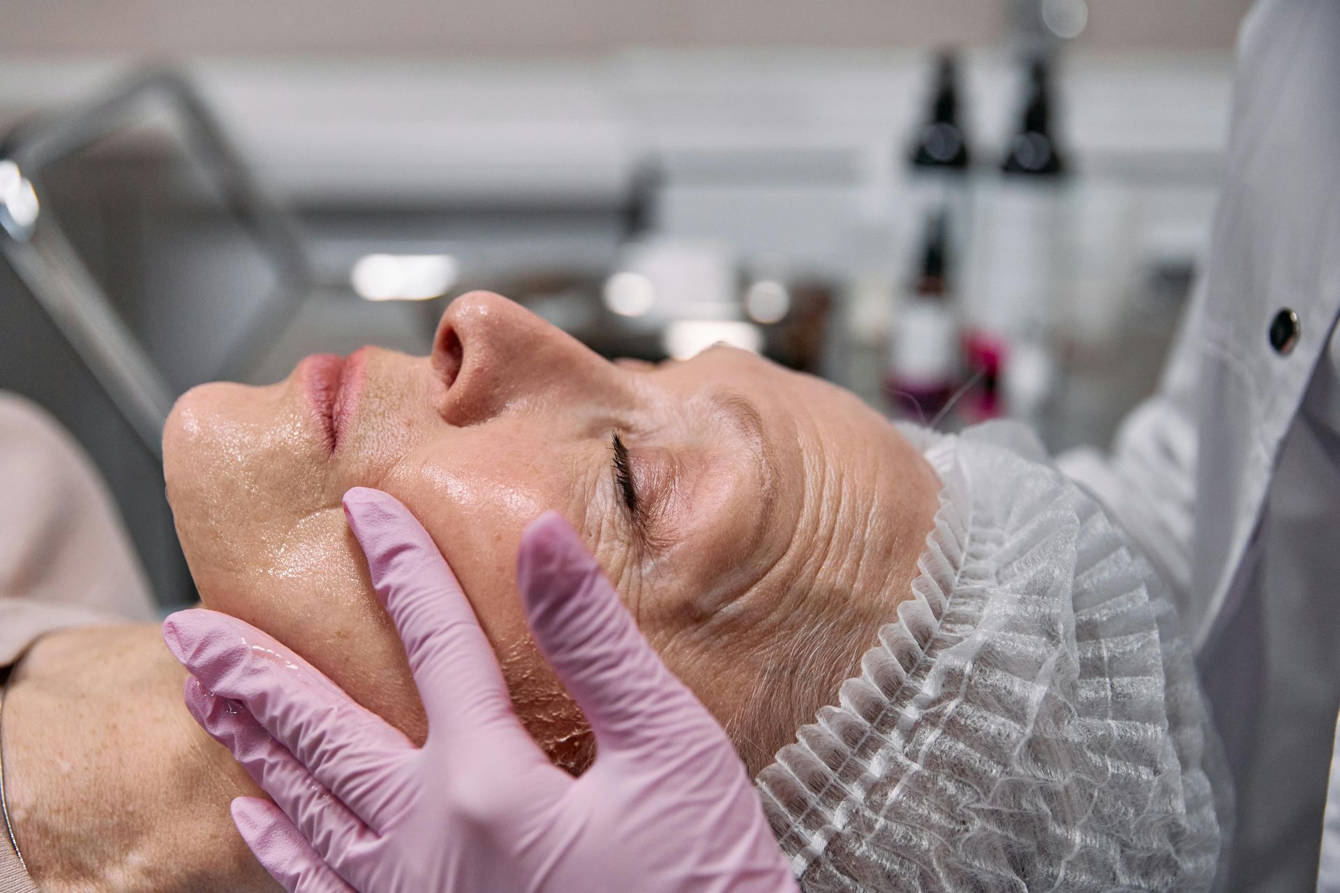 PRP & PRF Facial Rejuvenation & Microneedling
