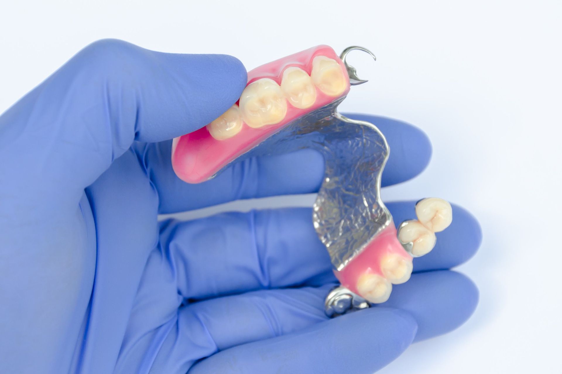 A Person Wearing Blue Gloves Is Holding A Denture In Their Hand — Dental Care Smithfield In Smithfield, QLD