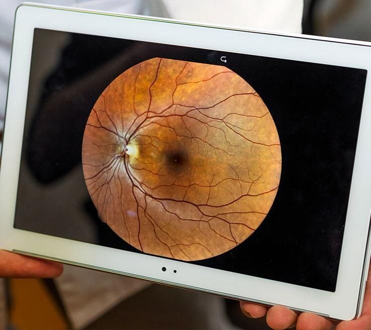 DR. RICARDO MARTÍNEZ BRIONES - retinopatía