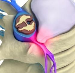 A medical professional examines a patient's back, palpating the shoulder and upper back area. A medical professional examines a patient's back, palpating the shoulder and upper back area.