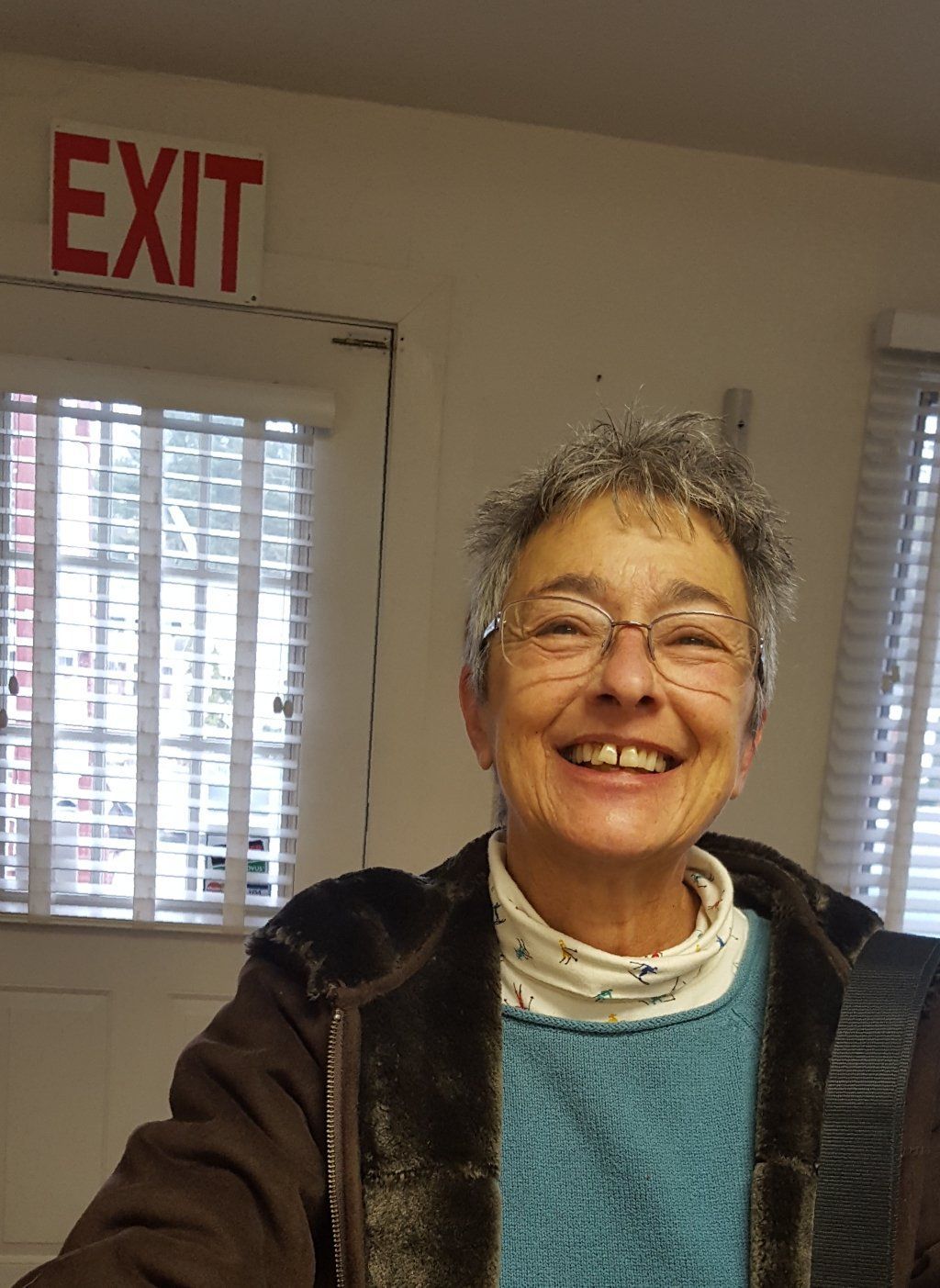 Patient Before 3 — Kennebunk, ME — Denture Solutions