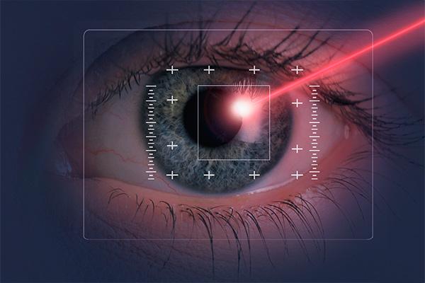 Ojo