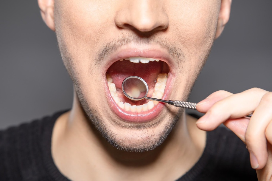 Oil Pulling | Patriot Family Dentistry