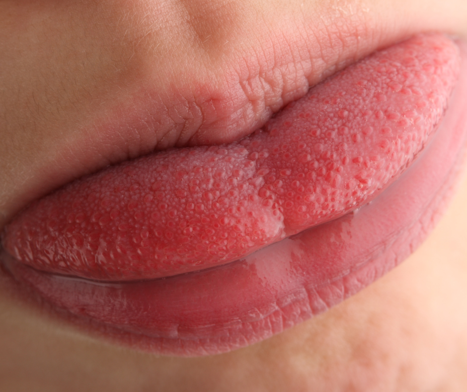 What Is So Special About Your Amazing Tongue? | Patriot Family Dental What Is So Special About Your Amazing Tongue? | Patriot Family Dental