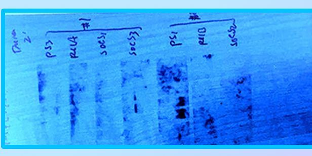 Difficult-To-Express Proteins Are Not Going to Solve Themselves