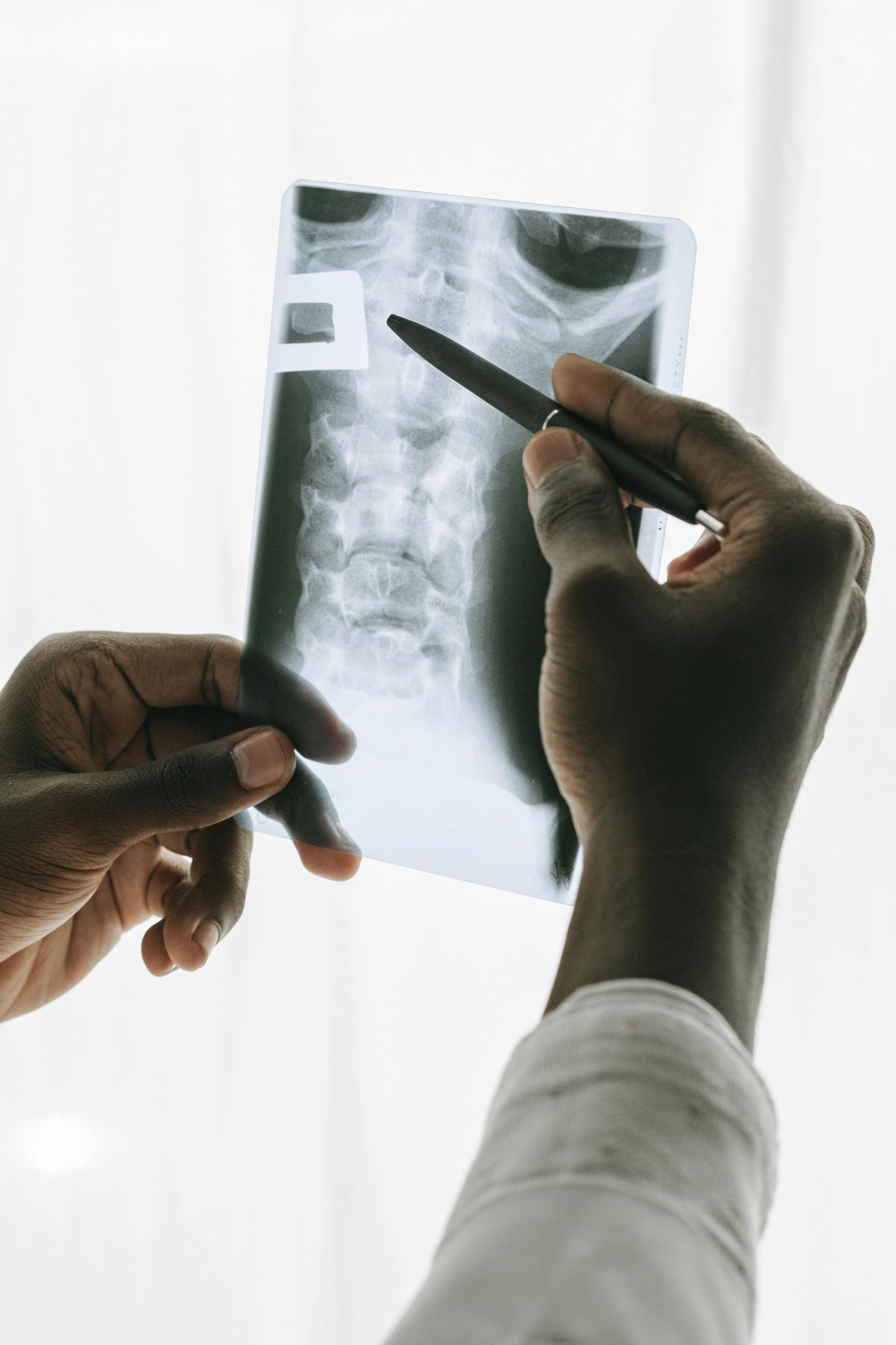 Spinal Scan image