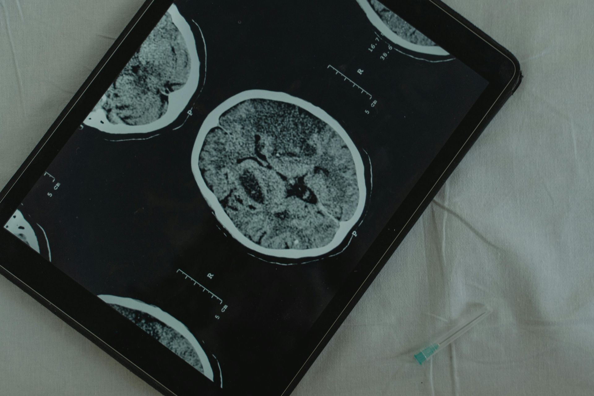 Brain scans and a finger pointing to them
