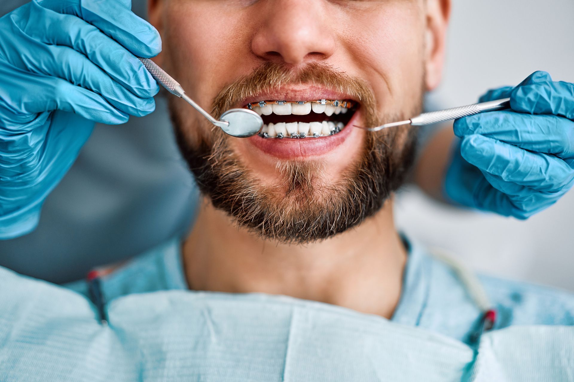 A bearded man with braces receiving a dental checkup from a family dentist in Byram, MS, at Parkway 