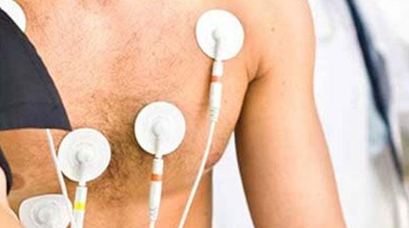 DR. ALEJANDRO VELDERRAIN ZAZUETA - PRUEBA DE ESFUERZO