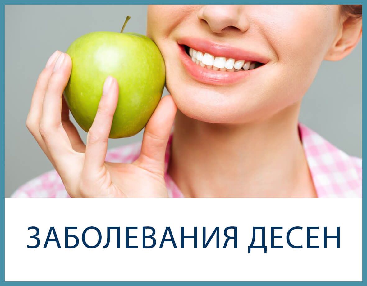 Woman biting a green apple beside Russian text “Заболевания десен” on a dental health banner