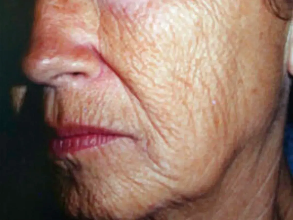 Plastic Surgery
