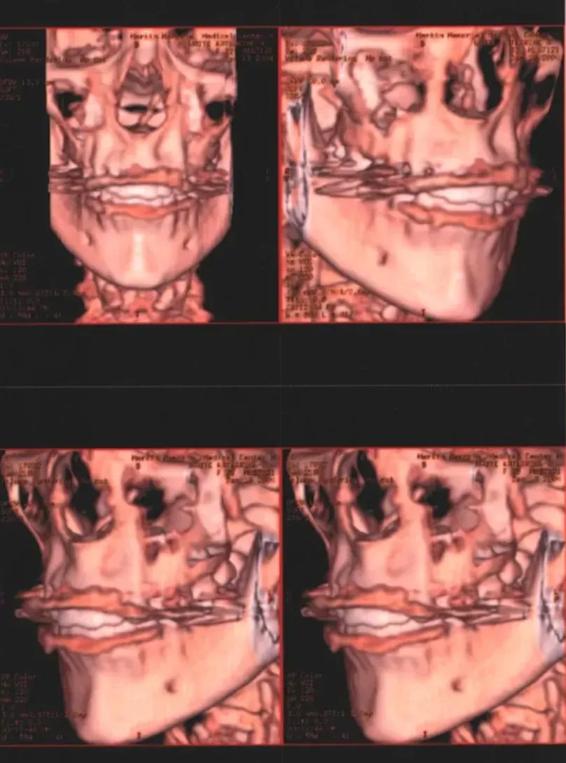 Reconstructive Surgery