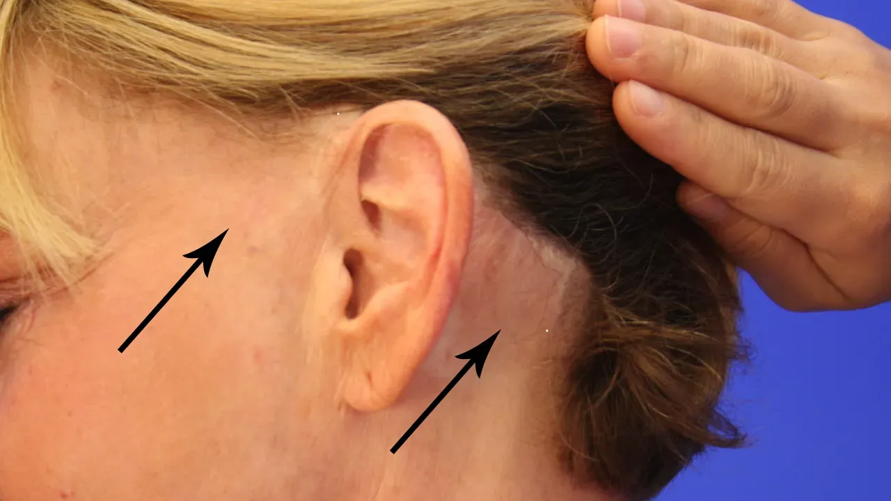 Facial Surgery