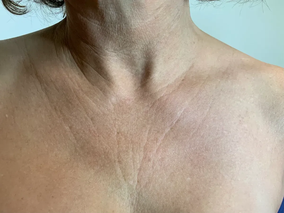 Facial Surgery
