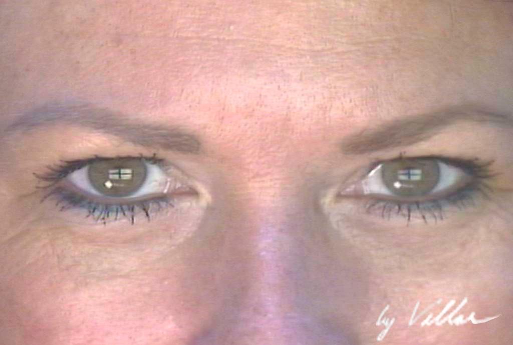 Facial Surgery