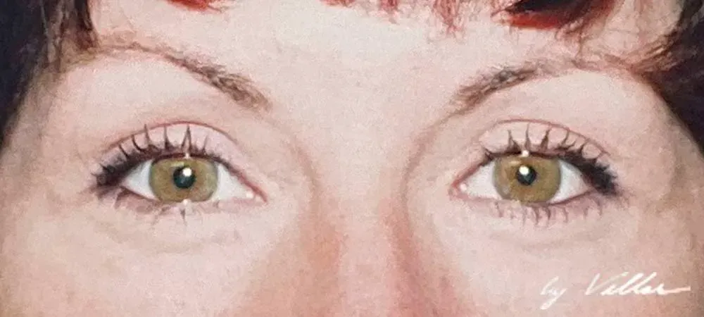 Facial Surgery