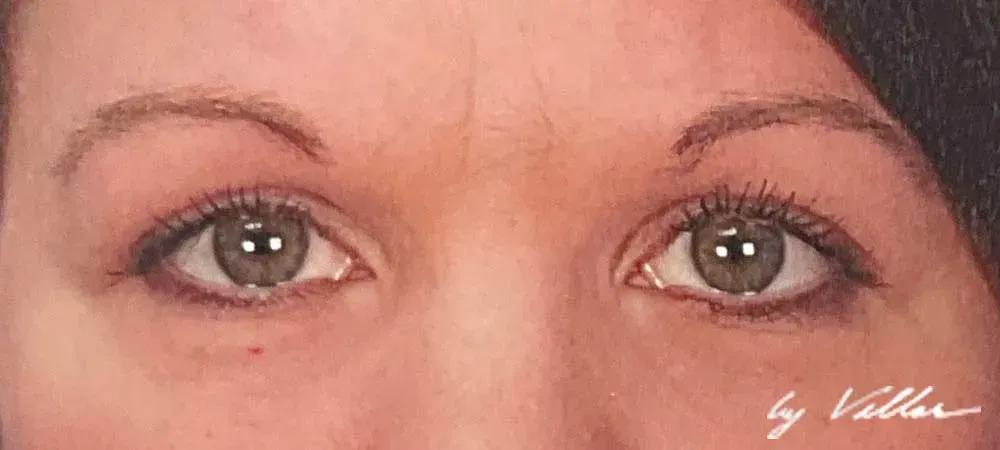 Facial Surgery