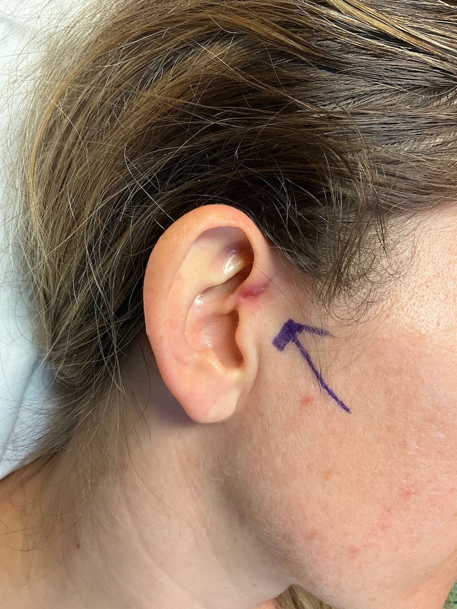 Facial Surgery