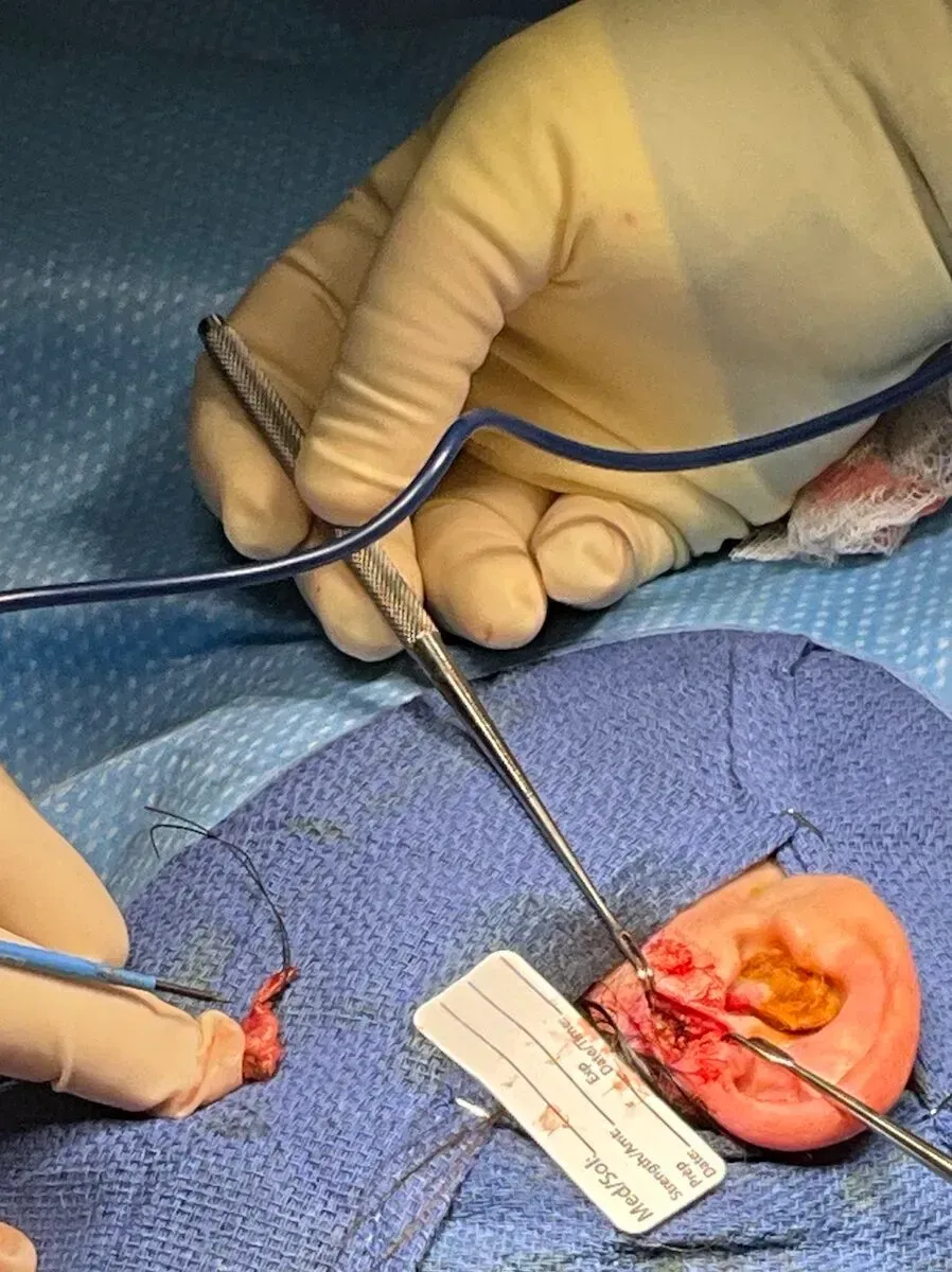 Facial Surgery