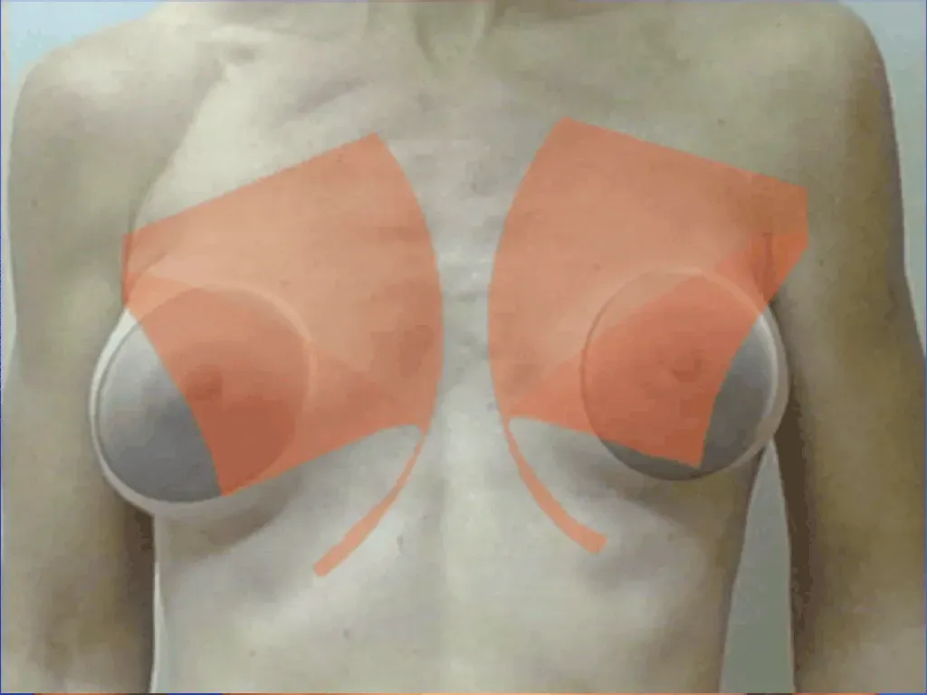 Plastic Surgery
