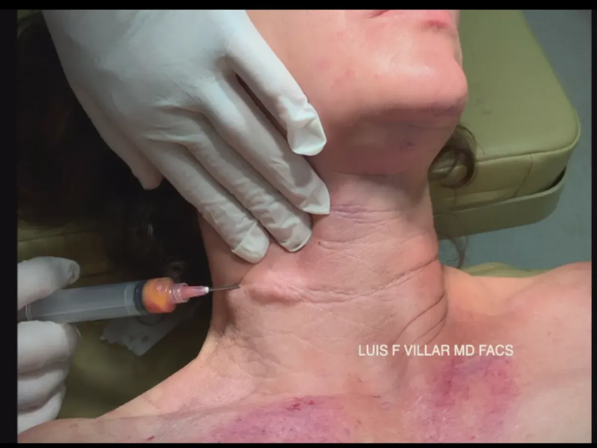 botox near me