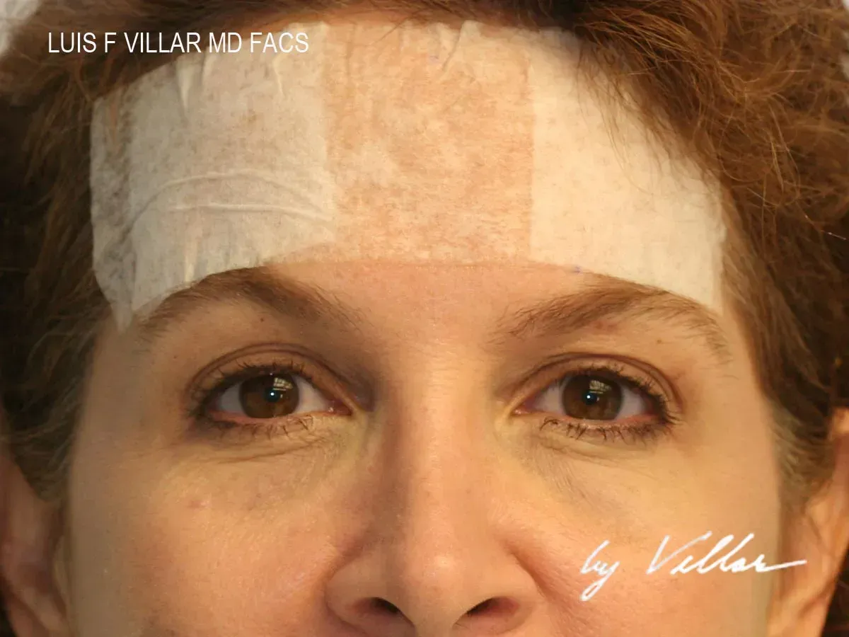 Facial Surgery