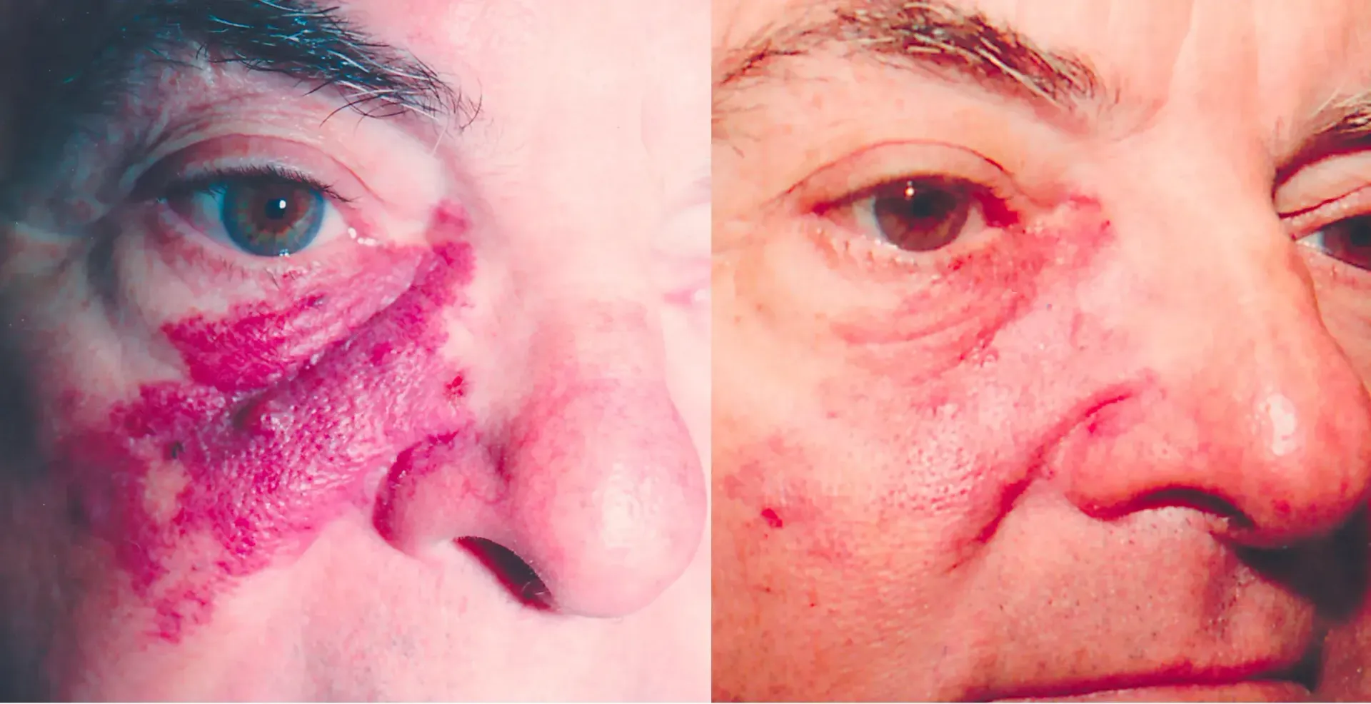 Reconstructive Surgery