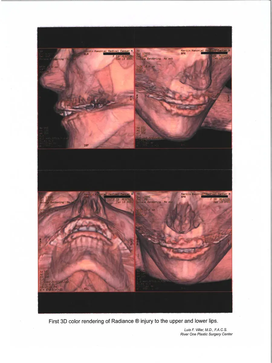botox near me